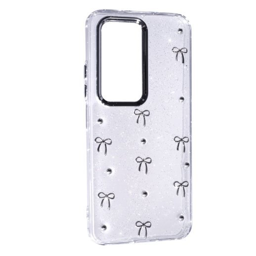 Чохол Glue Case Hit для Xiaomi Redmi 15 (EUROPE) 171 mm Bows