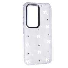 Чохол Glue Case Hit для Xiaomi Redmi 15 (EUROPE) 171 mm White Bows