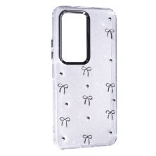 Чохол Glue Case Hit для Xiaomi Redmi 15 (Global) 169 mm Bows